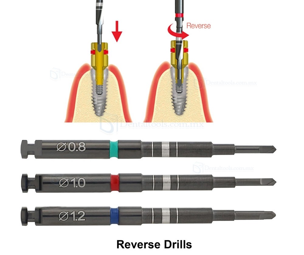 Kit Universal para Extracci&oacute;n de Tornillos Fracturados en Implantes Dentales